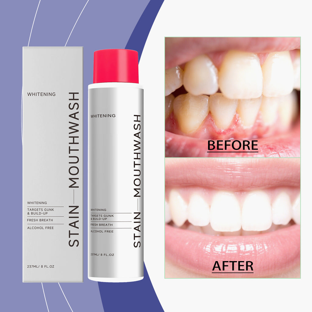 Stain-Removing Whitening Mouthwash 237ml — Fresh Breath & White Teeth