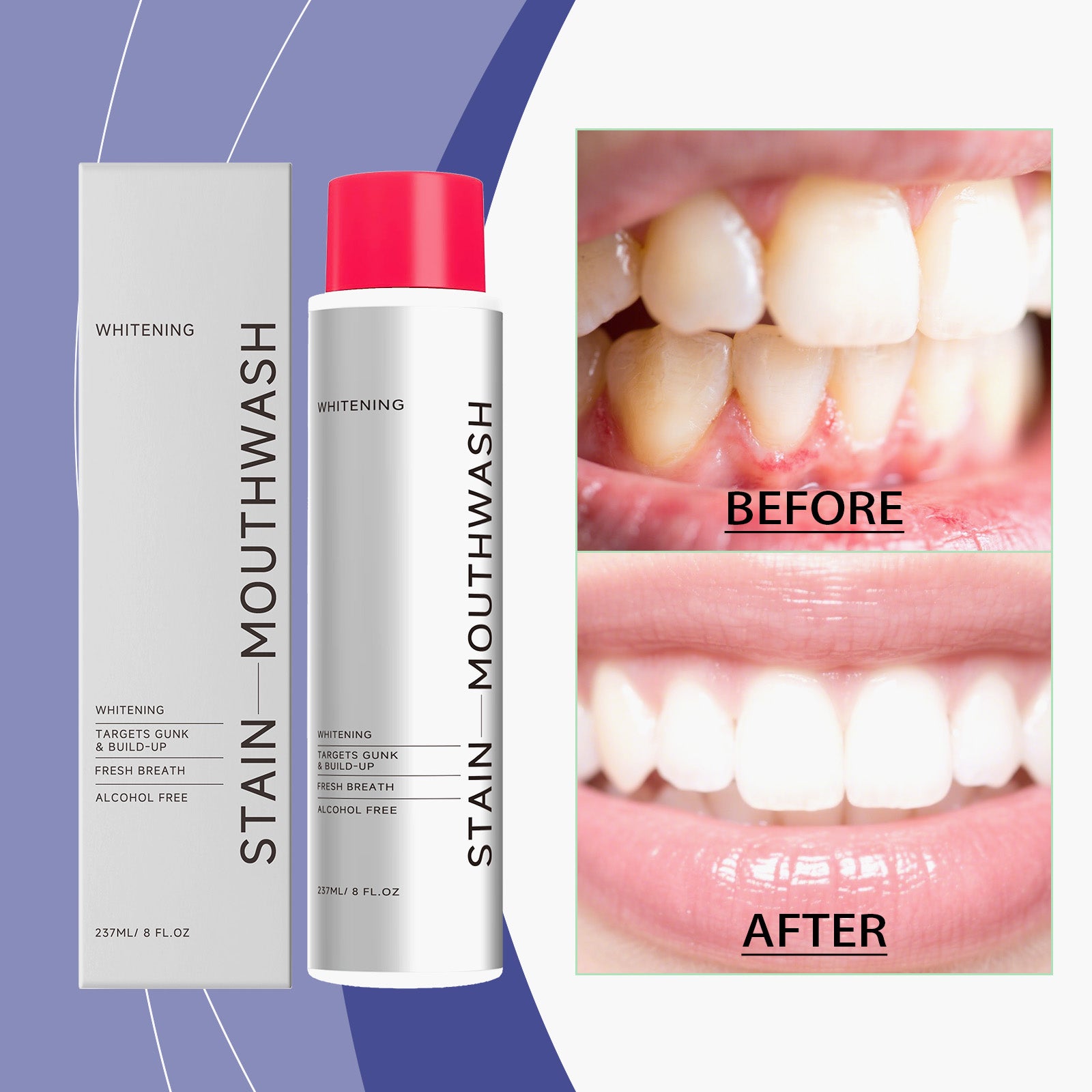 Stain-Removing Whitening Mouthwash 237ml — Fresh Breath & White Teeth